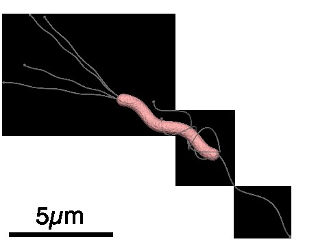 Helicobacter pylori bacteria